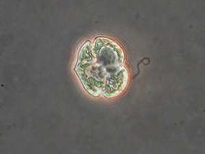 Photo by Mote Marine Laboratory Karenia brevis is a single-cell dinoflagellate which can create its own energy using photosynthesis or consume any of 12 food sources, including man-made nutrients as well as multiple naturally occurring substances. Native to the Gulf of Mexico, K. brevis blooms almost annually with the first fish kill documented in 1528. It produces toxins that can kill fish, birds and marine mammals. The toxins can become airborne and cause respiratory issues in people as far as three miles inland. Beach clean-ups, tourism losses and medical expenses average more than $1 million for each bloom event. 